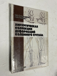 Хирургическая коррекция деформаций коленного сустава.